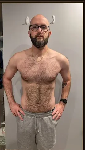 Chris after